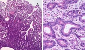 Ведется согласование дополнительных положений NCCN Harmonized Guidelines™